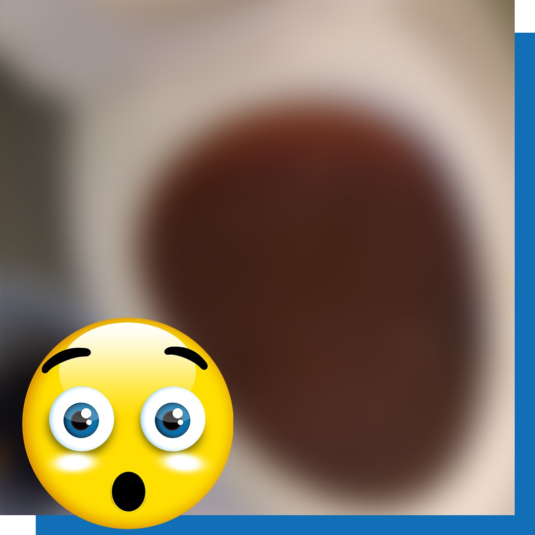 Clogged Toilet Repair By Insured Plumbers Downtown Toronto